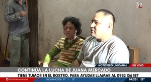 Mujer con tumor en el rostro solicita ayuda para cubrir gastos - Unicanal