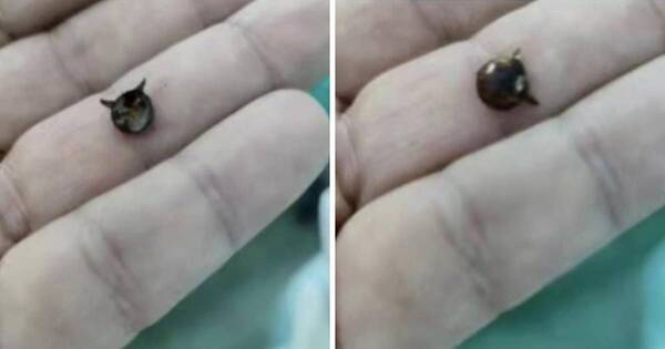 La Nación / Ineram: retiran objeto metálico del pulmón de un niño de un año