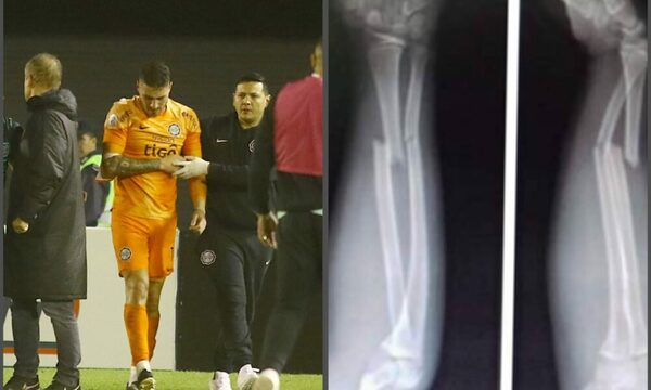 Hinchas de Olimpia furiosos con Da Silva por lesión de Oliveira: “Encima salió riéndose”