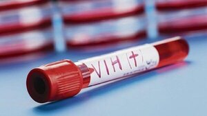 Advierten sobre “epidemia” de VIH en Paraguay: “El aumento es sostenido”