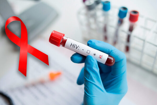 Advierten sobre “epidemia” de VIH en Paraguay: “El aumento es sostenido” - Oasis FM 94.3