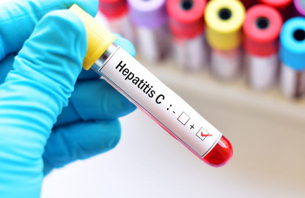 SALUD PÚBLICA CUENTA CON ANTIVIRALES PARA TRATAR LA HEPATITIS C