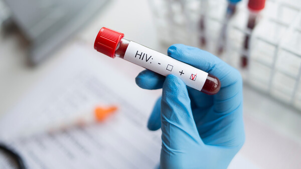 Diario HOY | Alarmante: hablan sobre "epidemia" de VIH por aumento sostenido de casos