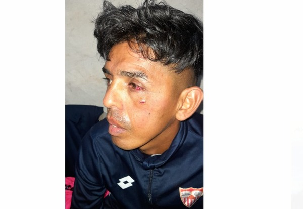 (Video) Revientan a golpes a “soplapitos”