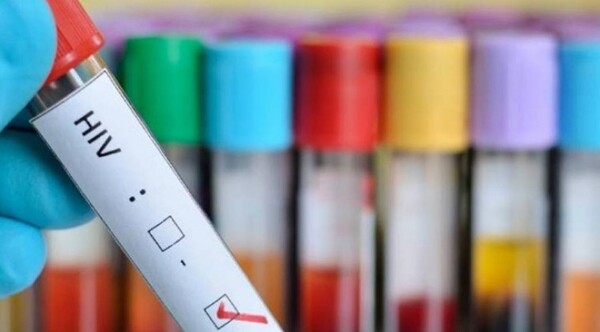 ADVIERTEN SOBRE “EPIDEMIA” DE VIH EN PARAGUAY: “EL AUMENTO ES SOSTENIDO” - Itapúa Noticias