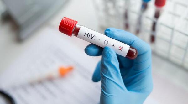 “Epidemia” de VIH, hablan de un alarmante aumento de casos. – Prensa 5
