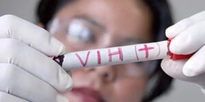 Destacan la importancia de la detección del VIH para su tratamiento - Nacionales - ABC Color