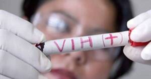 La Nación / Preocupa aumento de casos de VIH en Paraguay, advierte el MSP