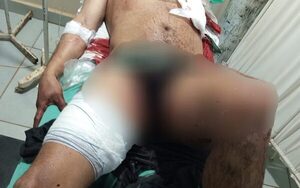 Hombre fue atacado en Mallorquín