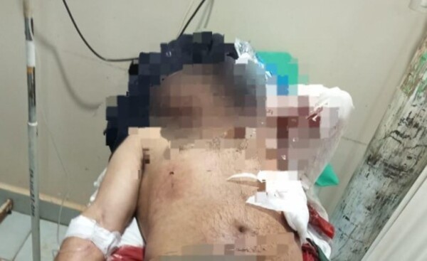 Hombre que cuidaba de un maizal fue herido de varias puñaladas