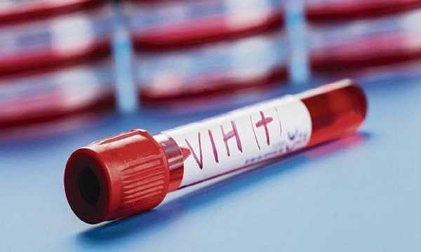 Preocupa aumento de casos de VIH y el 60 % corresponde a jóvenes - OviedoPress