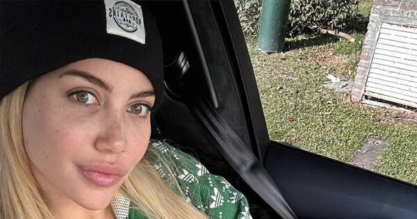 La Nación / Wanda Nara rompió el silencio con respecto a su salud, ¿qué enfermedad padece?