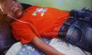 (Video) “Ñandu kavaju” pico a niño y lo dejó internado: “Tuve que estirar la araña para sacarle de la cara”