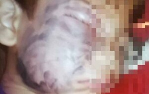 Niño de apenas 6 añitos fue picado por una tarántula y necesita ayuda – Prensa 5
