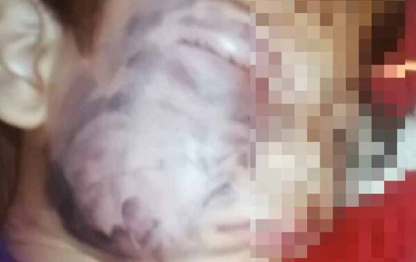 Niño de apenas 6 añitos fue picado por una tarántula y necesita ayuda – Prensa 5