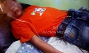 PIDEN AUXILIO PARA UN NIÑO DE SEIS AÑOS FUE PICADO POR UN TARÁNTULA EN EL ROSTRO!!! - La Voz del Norte