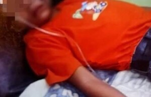 Tarántula pico a un niño en la cara y lo dejó internado - Noticiero Paraguay