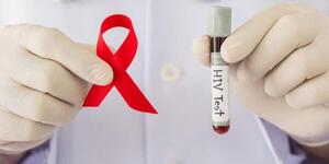 ¡Alarmante! Especialistas advierten sobre epidemia de VIH, ante aumento sostenido de casos en el país