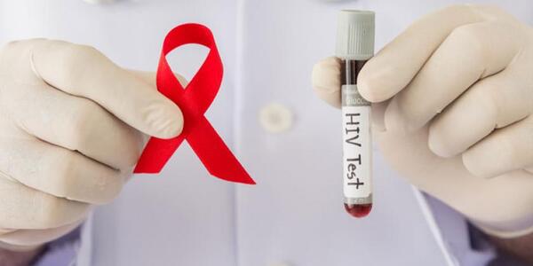 ¡Alarmante! Especialistas advierten sobre epidemia de VIH, ante aumento sostenido de casos en el país