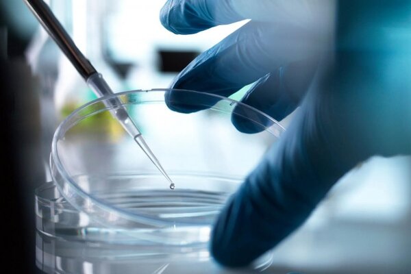 Un nuevo caso de remisión del VIH tras un trasplante de médula ósea - ADN Digital