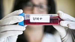 Diario HOY | Un nuevo caso de remisión del VIH tras un trasplante de médula ósea
