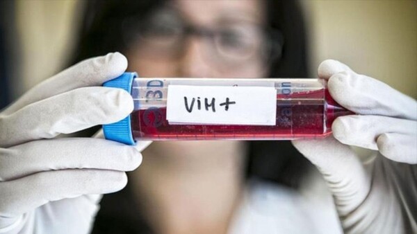Diario HOY | Un nuevo caso de remisión del VIH tras un trasplante de médula ósea
