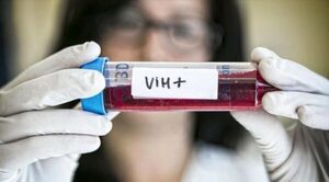 Un nuevo caso de remisión del VIH tras un trasplante de médula ósea
