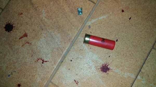 Matan con arma de fuego a hombre en barrio Santa Ana - Nacionales - ABC Color