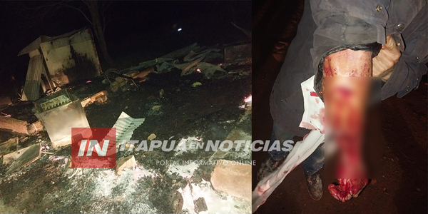 JOVEN HABRÍA AGREDIDO A SU TÍO A “MACHETAZOS” E INCENDIADO DOS VIVIENDAS - Itapúa Noticias