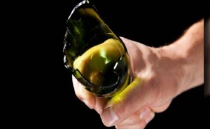 Imputan a joven sindicado de desfigurar rostro de su expareja
