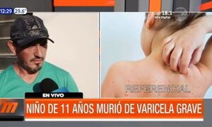 Niño de 11 años murió de varicela en Itauguá | Telefuturo