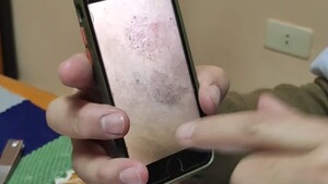 Niño supuestamente picado por una tarántula se encuentra bien