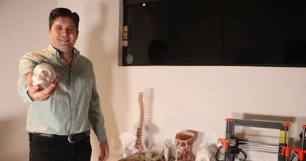 La Nación / Impresión 3D: la medicina del futuro que ya está presente en el Paraguay