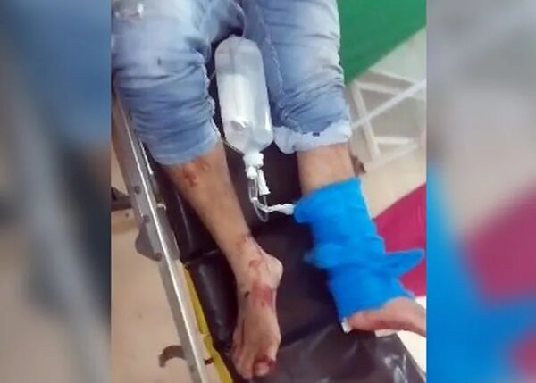 Conductor resulta herido en extrañas circunstancias - ABC en el Este - ABC Color
