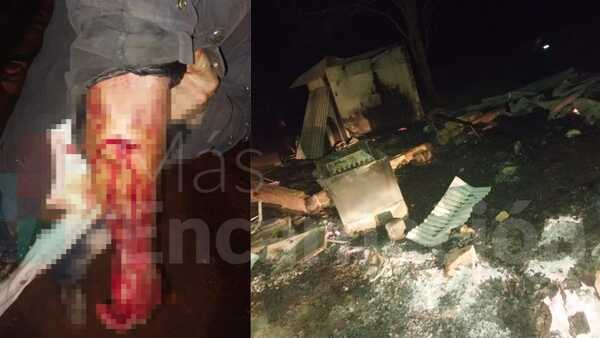 Joven agrede a su tío y luego incendia totalmente su vivienda
