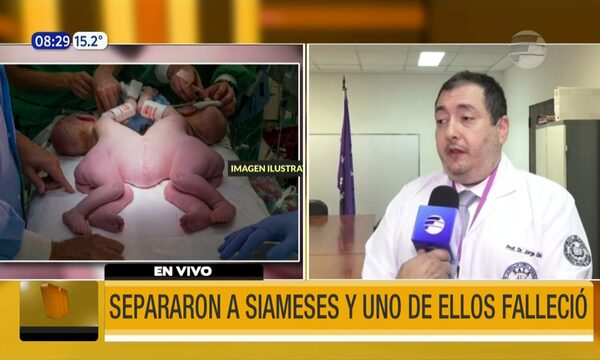 Separaron a siameses y uno de ellos falleció | Telefuturo