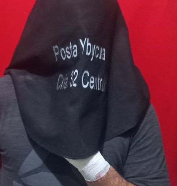 Detenido por matar a puñaladas a un Pitbull | 1000 Noticias