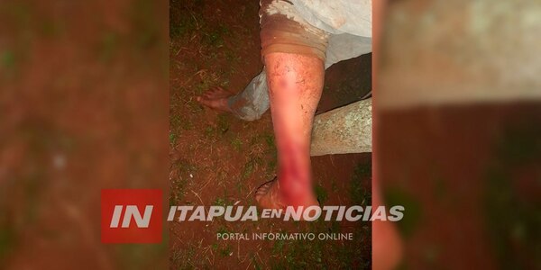 HOMBRE BALEADO DIJO QUE LO CONFUNDIERON CON UN "RATERO" - Itapúa Noticias