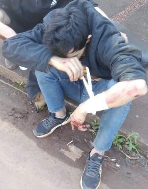 Chocan a motociclista y se dan a la fuga