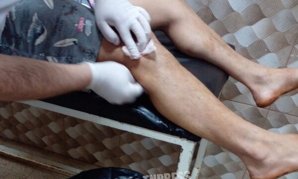 Reciclador es herido por lunático cuando hurgaba en un basurero en Hernandarias – Diario TNPRESS