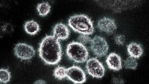 Diario HOY | Analizan una muestra de tierra: descubren virus gigantes con formas "inimaginables"
