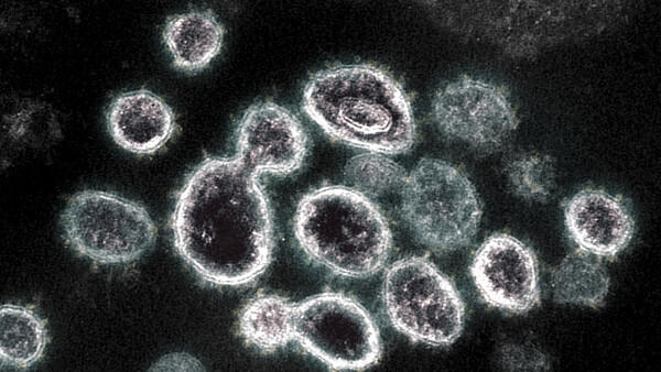 Diario HOY | Analizan una muestra de tierra: descubren virus gigantes con formas "inimaginables"
