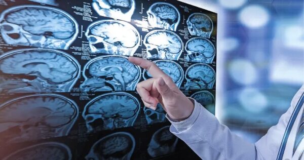 Medicamento contra la esclerosis múltiple se producirá fuera de EE.UU. - Ciencia - ABC Color