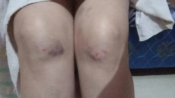 Denuncian por intento de homicidio a un concejal de J. Augusto Saldivar - Noticiero Paraguay
