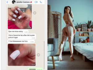 ¡Así le dejaron las uñas y se plagueó!