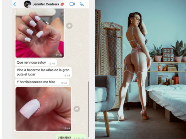¡Así le dejaron las uñas y se plagueó!