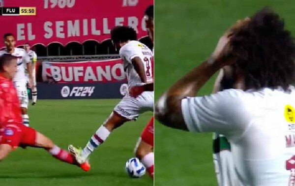 La escalofriante lesión que sufrió un jugador de Argentinos Juniors en la Copa Libertadores – Prensa 5