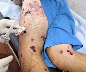 Investigan brutal tortura en cárcel de CDE