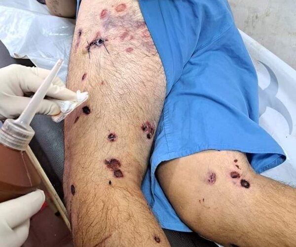 Investigan brutal tortura en cárcel de CDE