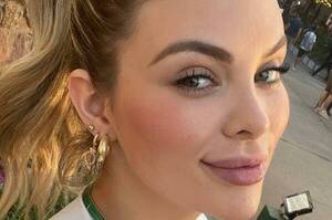Modelo explicó qué pasó con sus labios